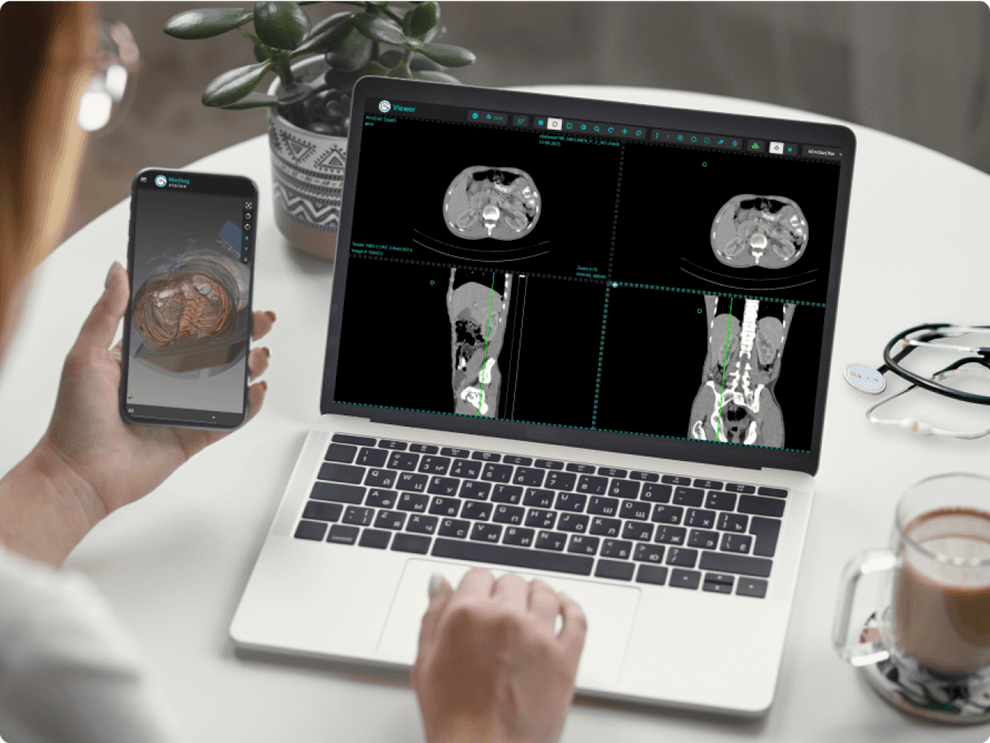 MPR & 3D Visualization