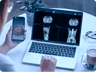 MPR & 3D Visualization